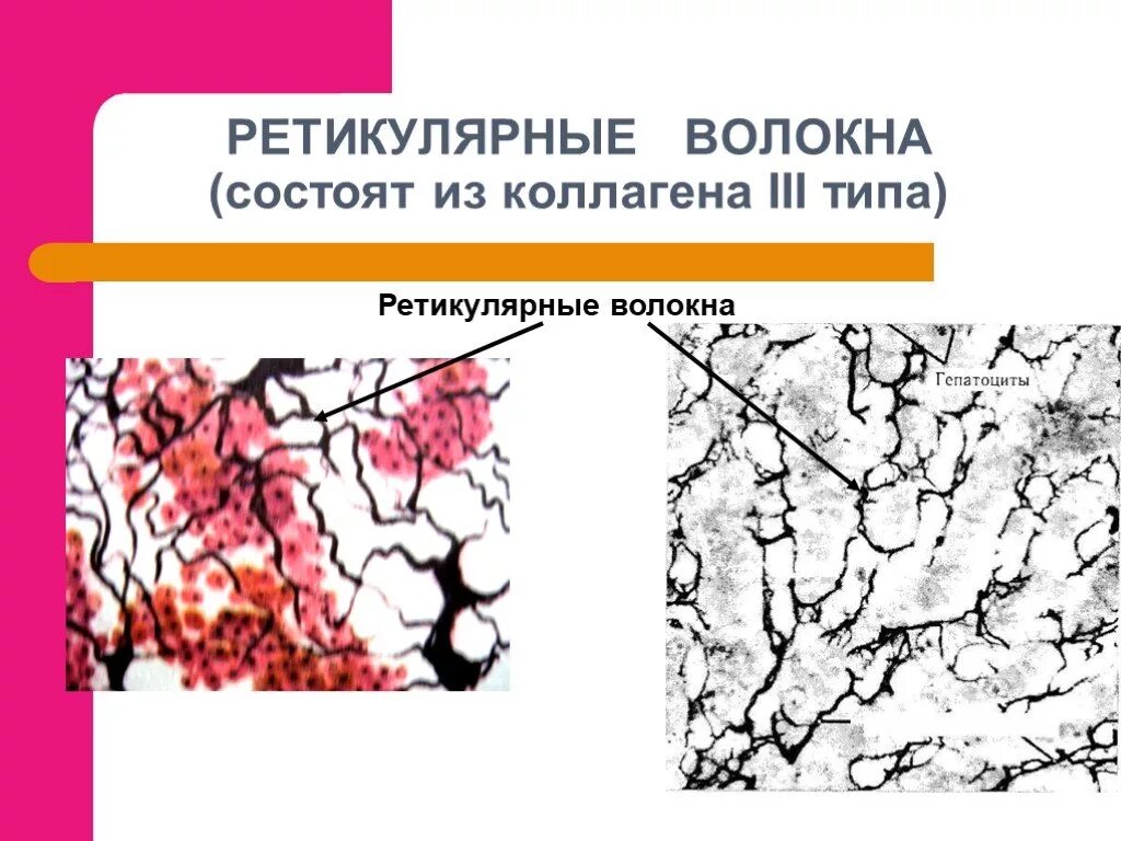Характеристика ретикулярных волокон. Ретикулярные клетки гистология. Ретикулярная соединительная ткань гистология. Ретикулярные волокна строение. Ретикулярная соединительная ткань гистология.