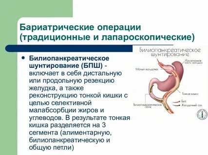 Бариатрическая операция омск