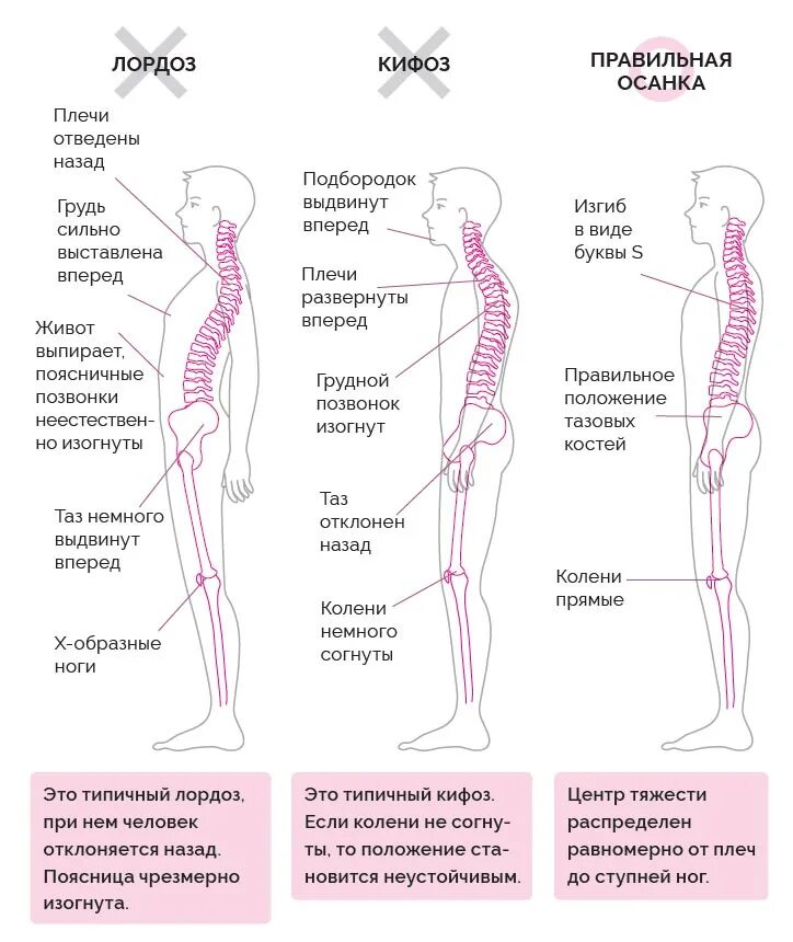 Положение лопаток при правильной осанке. Правильная осанка. Правильное положение позвоночника. Положение позвоночника при правильной осанке. Изгибы костей