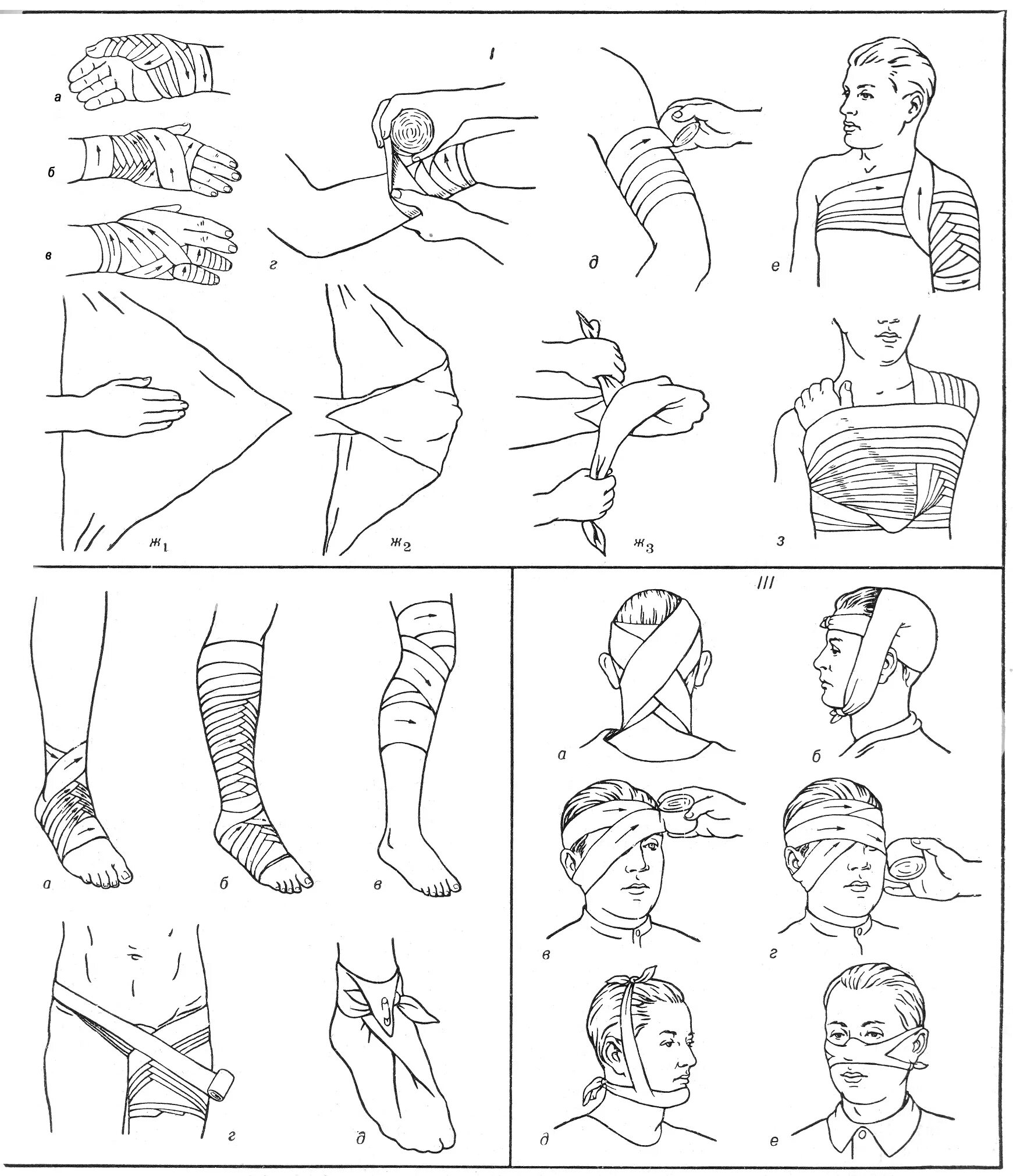 Спиральная повязка на конечность. Положения конечностей при повязках. Наложение повязки на конечность. Черепашья сходящаяся повязка показания. Техника наложения восьмиобразной повязки на голеностопный сустав.