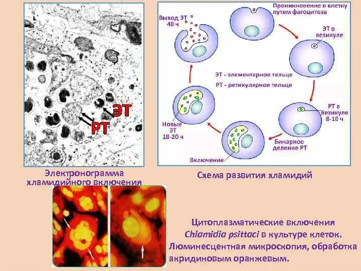 Жизненный цикл хламидий. Инфекционная форма хламидий. Элементарные тельца хламидий по Романовскому Гимзе. Хламидии микроскопия по Романовскому Гимзе. Хламидии Романовскому Гимзе.