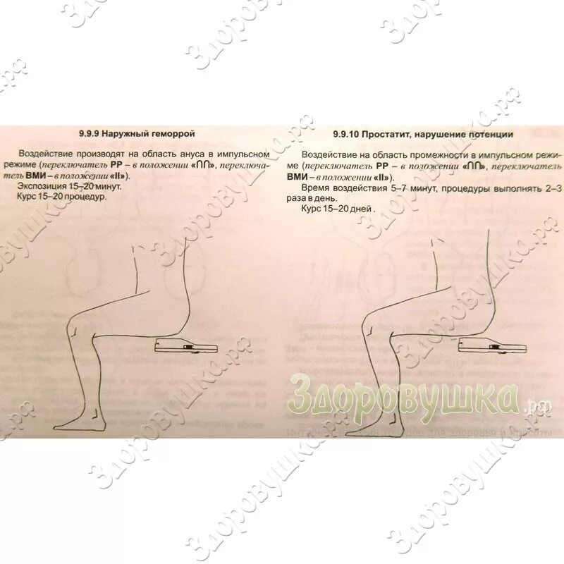 Магнитотерапии АМТ-02 "Магнитер". Магнитёр АМТ-02 инструкция. Аппарат Магнитер методики. Магнитер АМТ-02 от простатита. Алмаг при простатите