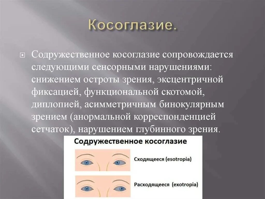 Косоглазие симптомы. Этиология содружественного аккомодационного косоглазия. Содружественное расходящееся монолатеральное косоглазие. Классификация косоглазия. Классификация косоглазия офтальмология.