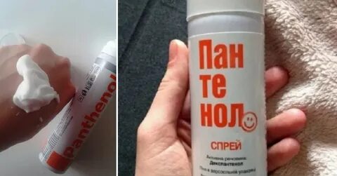 Что лучше от ожогов