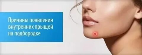 Причины прыщей после 40 лет