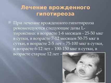 Гипотиреоз у подростка