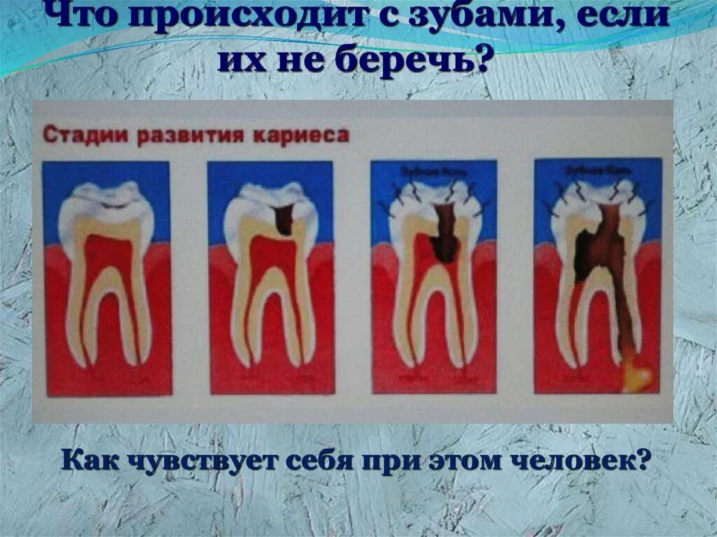 Если не чистить зубы картинки. Если не чистить зубы картинки. Что будет если не чистить зубы картинки для детей. Дети которые не чистят зубы. Что будет если не чистить зубы.