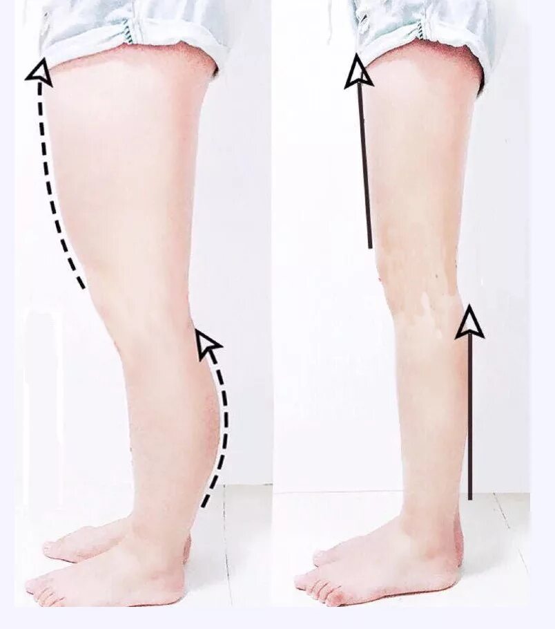 Короткая и длинная голень. Сделать ноги стройнее. Как визуально сделать ноги стройнее. Что делать чтобы ноги были