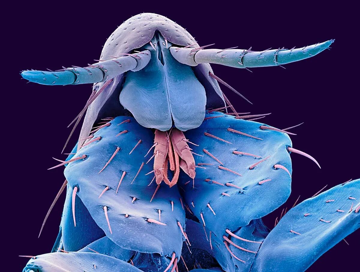 Бактерии на мухе. Ротовой аппарат блохи. Насекомые под микроскопом. Насикомыепод микроскопом. Головы насекомых под микроскопом.