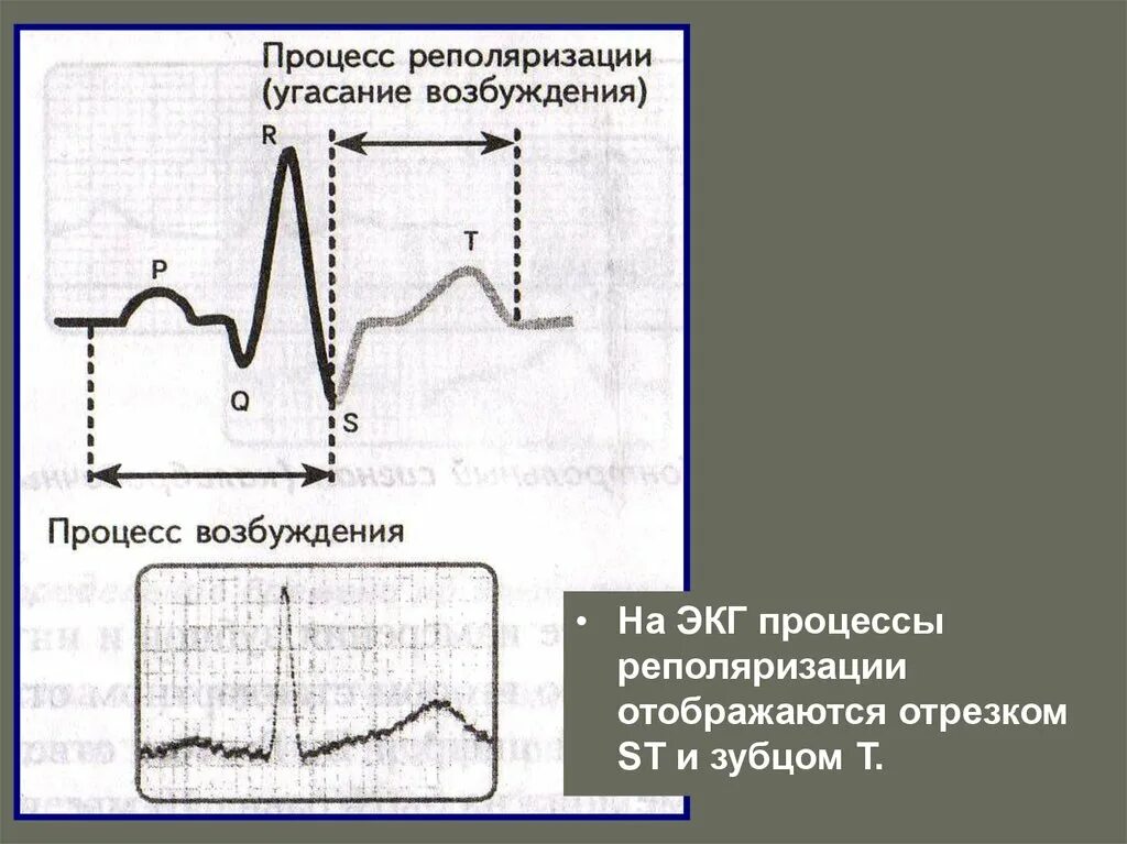 Умеренные изменения реполяризации