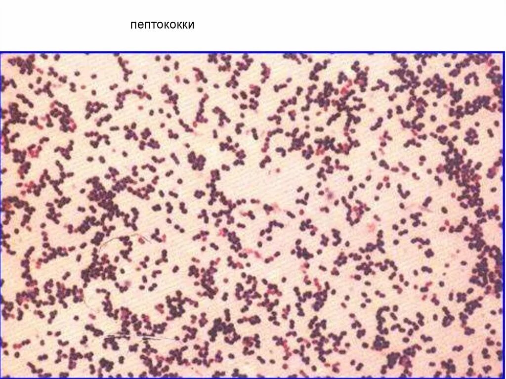 Peptostreptococcus. Пептококки и пептострептококки. Пептококки пептострептококки вейлонеллы. Анаэробные пептострептококки. Пептококки микробиология.