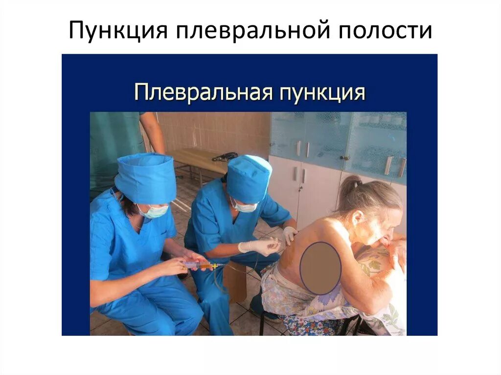 Пункция экссудата. Плевральная пункция (торакоцентез). подготовка к плевральной пункции алгоритм. подготовка к пункции плевральной полости. подготовка пациента к плевральной пункции.