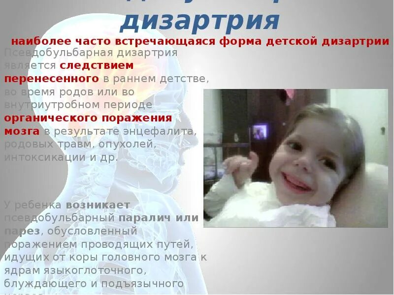 Дизартрия логопед. Дизартрия языка у детей. Дизартрия языка у детей. Массаж языка логопедический ребенку. Дизартрия медикаментозная терапия у детей.