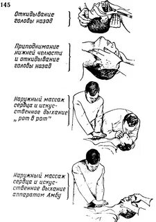 Руки при искусственном дыхании