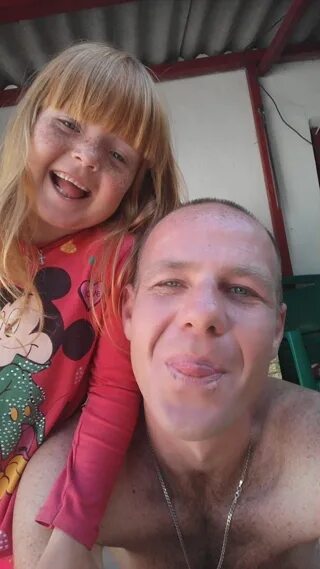 Рыжий гена. У человека веснушки доминируют. Рыжеволосые люди. Гена рыжий. Mc1r рыжий ген.