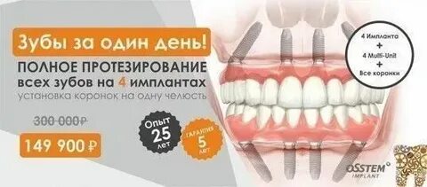 Гарантия на зубы после лечения
