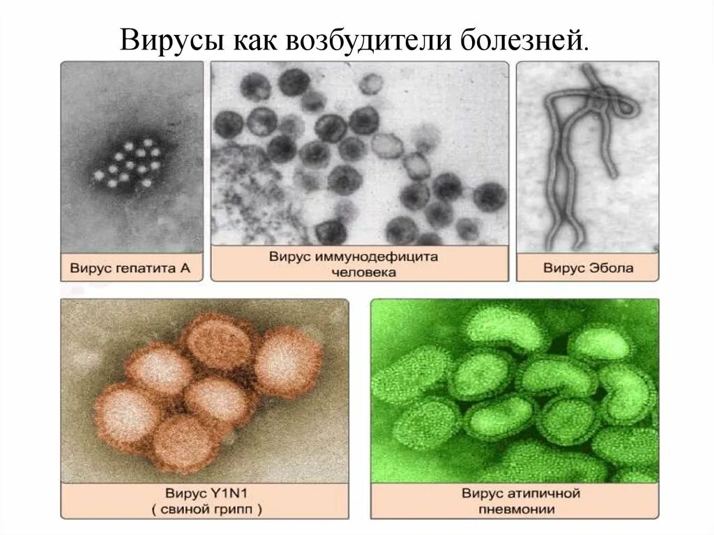 Основные вирусные заболевания человека. Вирусы возбудители болезней. Вирусы возбудители заболеваний человека. Вирусы возбудители опасных заболеваний человека. Возбудители каких заболеваний - вирусы?.