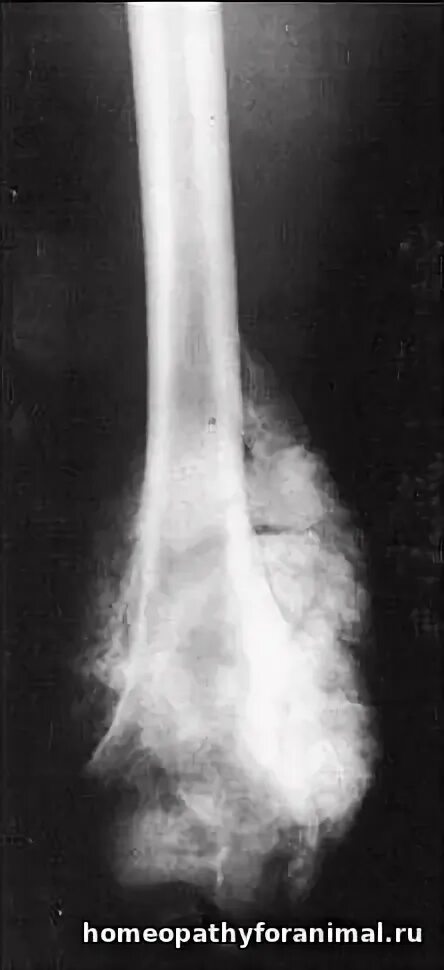 Ewing Sarcoma at emaze Presentation
