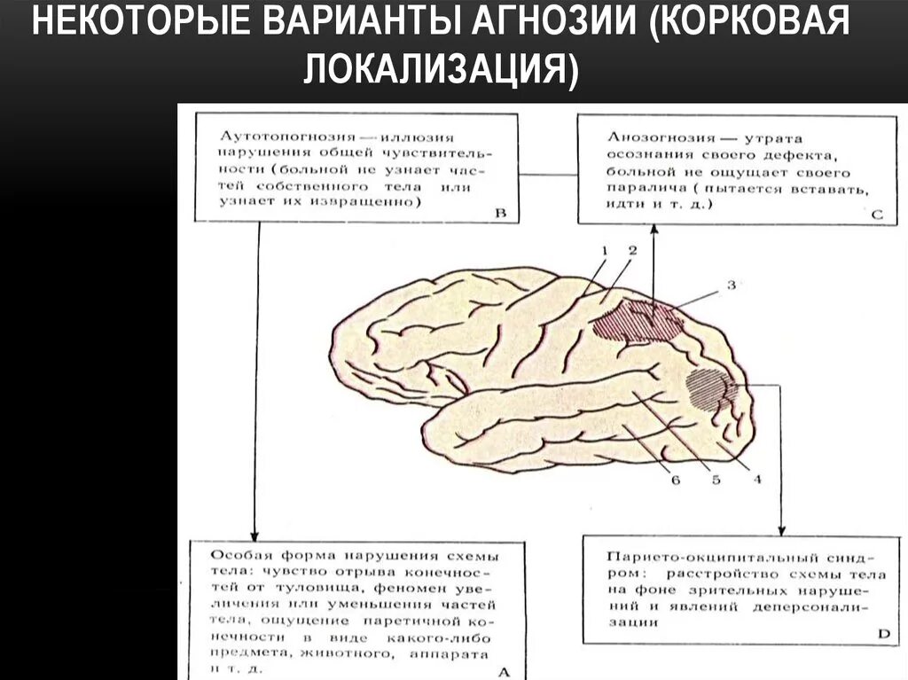 Поражения корково мозга. Агнозия возникает при поражении коры головного мозга. Локализация поражения при агнозии. Цветовая агнозия локализация. Предметная агнозия локализация.