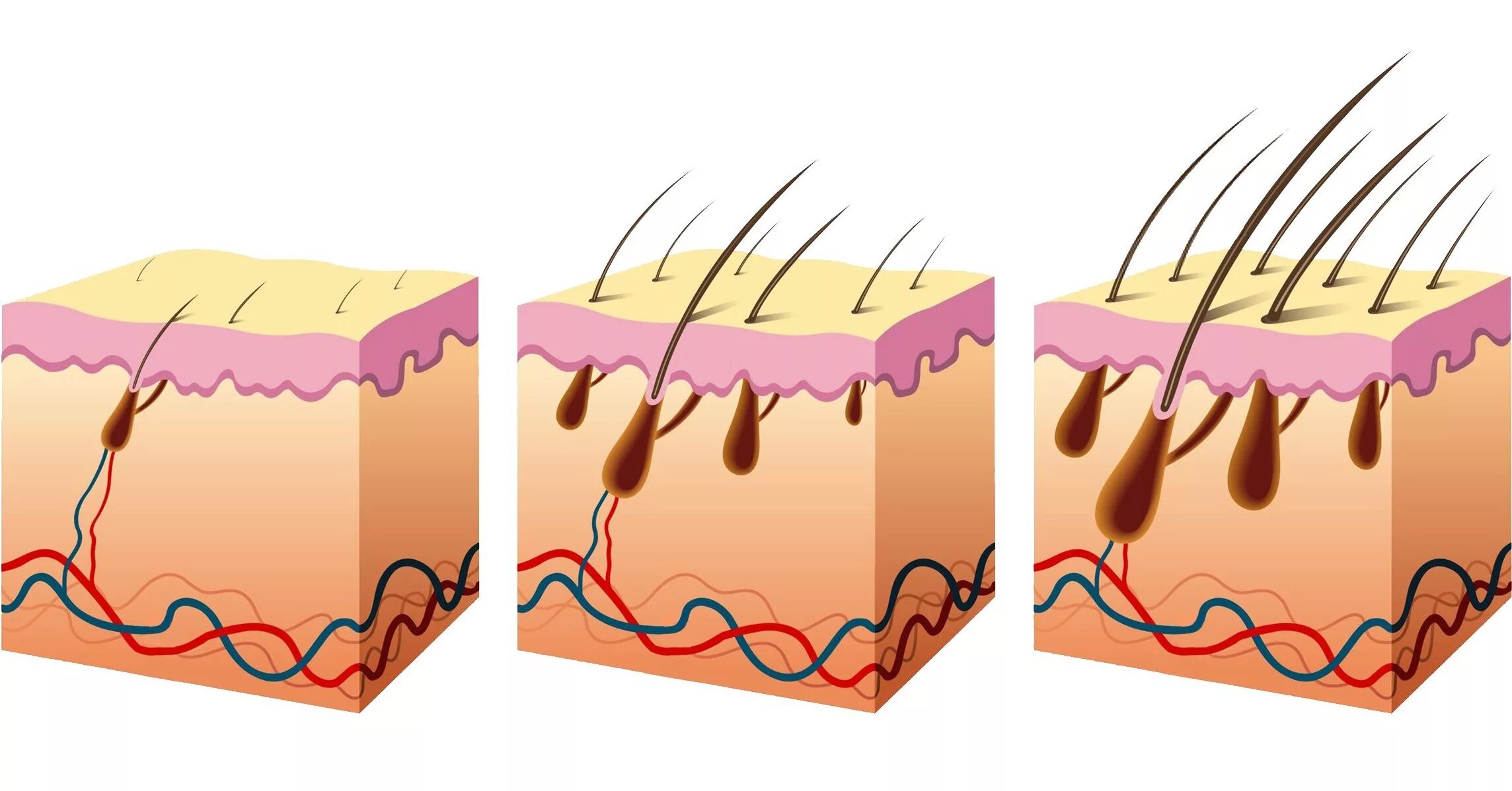Схема роста волос. Волосяная луковица. Анаген катаген телоген. Выпадение волос схема. Рост волоса происходит за счет