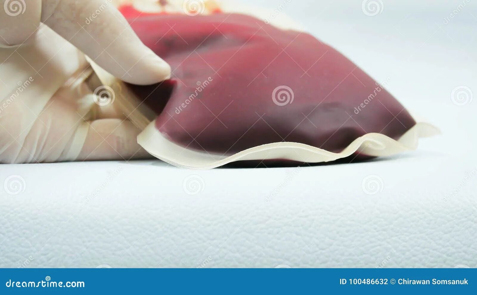 Кровяной мешочек. Сукровично-кровянистые. Кровяной мешочек. Кровяной мешочек. Кровяной мешочек.