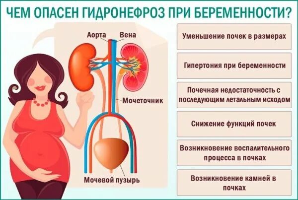 Гидронефроз что это и как лечить