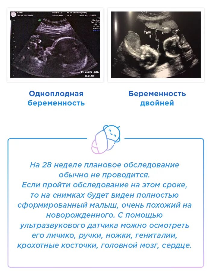 УЗИ плода на 28 неделе беременности. УЗИ многоплодная беременность 28 недель. Вес плода на 32 неделе