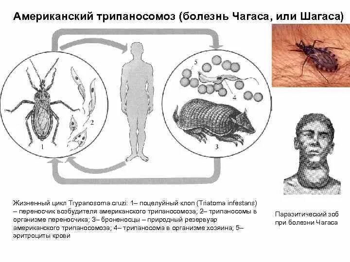 Жизненный цикл американской трипаносомы. Американский трипаносомоз жизненный цикл. Трипаносома американская основной и промежуточный хозяин. Жизненный цикл трипаносомы Чагаса.