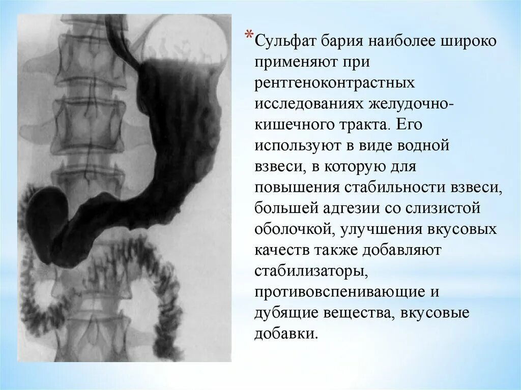 Сульфат бария используют в качестве. Рентген исследование желудка с барием. Сульфат бария рентген желудка.