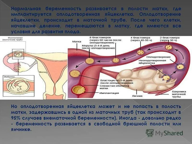Симптомы первый беременности триместр беременности. Первые симптомы беременности на ранних сроках. Как происходит беременность женщины. Как происходит беременность женщины. Изменения тела при беременности.