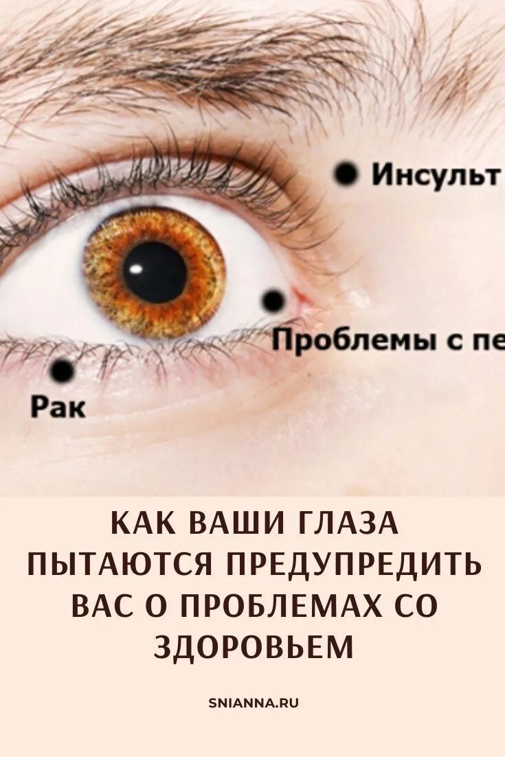 Как по глазам определить болезни. Диагностика заболеваний по глазам. болезни по глазам человека. определить болезнь по глазам.