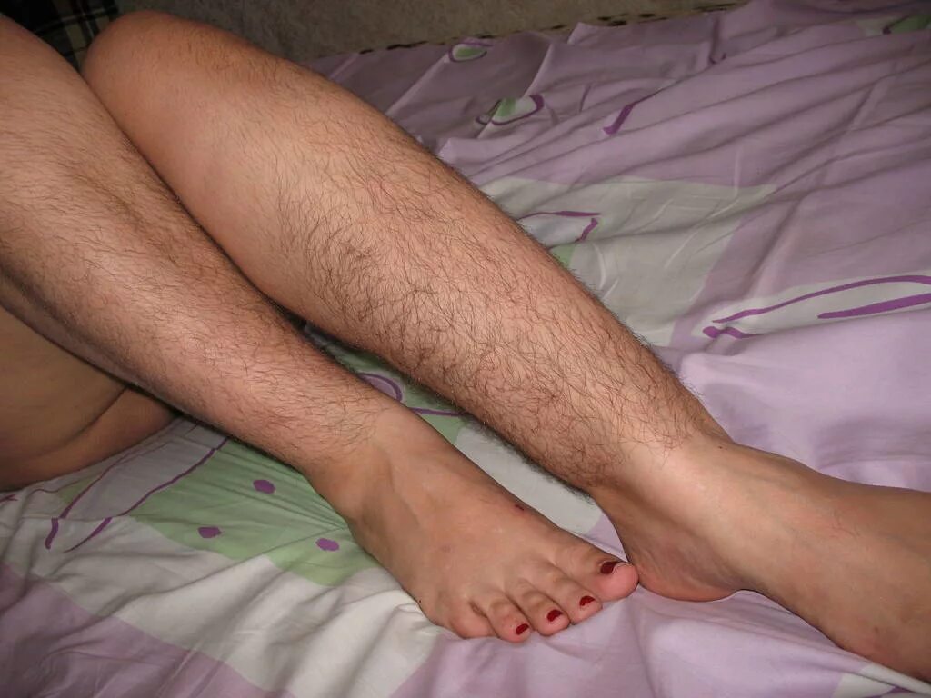 Hairy foot. НОГР волосаьые женские.