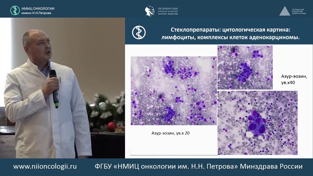 Нии петрова вакцина. НМИЦ онкологии им.Петрова. Мультидисциплинарный подход в онкологии. ФГБУ НМИЦ онкологии им. н. н. Петрова Минздрава России. Иммуноцитохимический метод онкология.