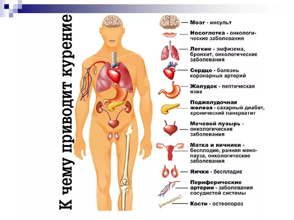 Заболевание курящих людей. Заболевания вызванные курением. Болезни вызванные табакокурением. Заболевания вызванные курением табака. Какие заболевания вызывает табакокурение.