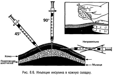 В организме возникает после введения
