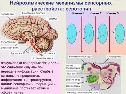 Нарушение сенсорной системы