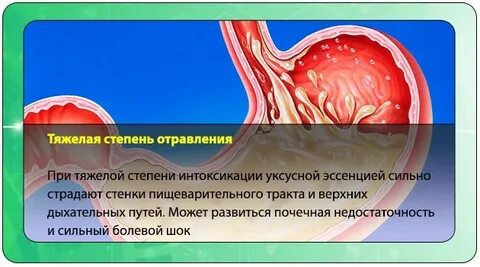 Какие признаки отравления желудка