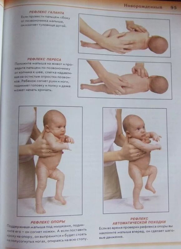 Рефлекс опора новорожденного. Рефлекс опоры и автоматической ходьбы новорожденных. Рефлексы новорожденного рефлекс опоры. Рефлекс автоматической походки у новорожденного.