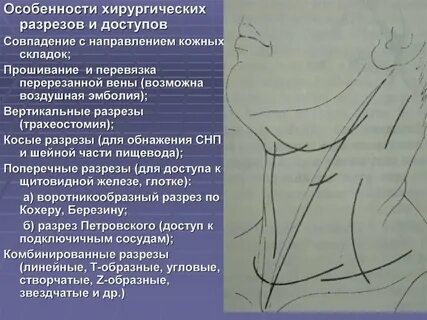 Хирургический разрез