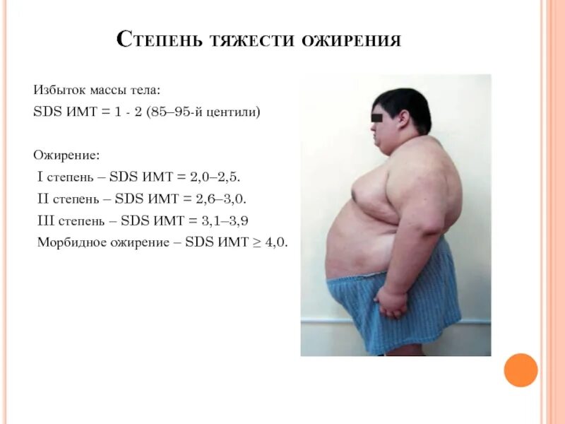 Алиментарное ожирение 1 степени. Алиментарным ожирением 3-4 степени. Ожирение 2 степени у мужчин как определить. Ожирение первой степени. Алиментарное ожирение 2 степени.
