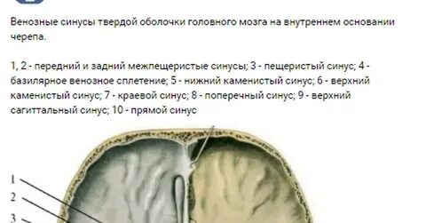 Левый поперечный синус