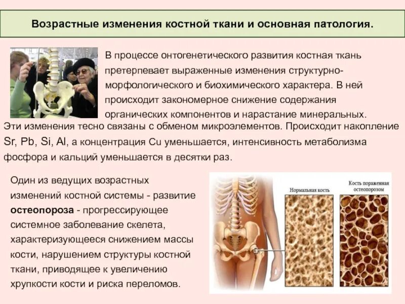 Изменение костной ткани. Возрастные изменения кости. Возрастные изменения пластинчатой костной ткани. Возрастные изменения скелета человека.