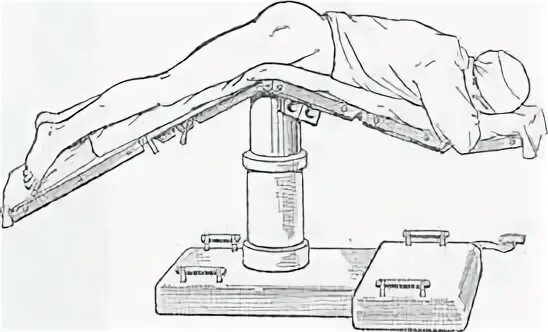 Положение больного на столе. Литотомическое положение на операционном столе. Литотомической позиции на операционном столе. Положение пациента на операционном столе. Положение пациента при операции на прямой кишке.
