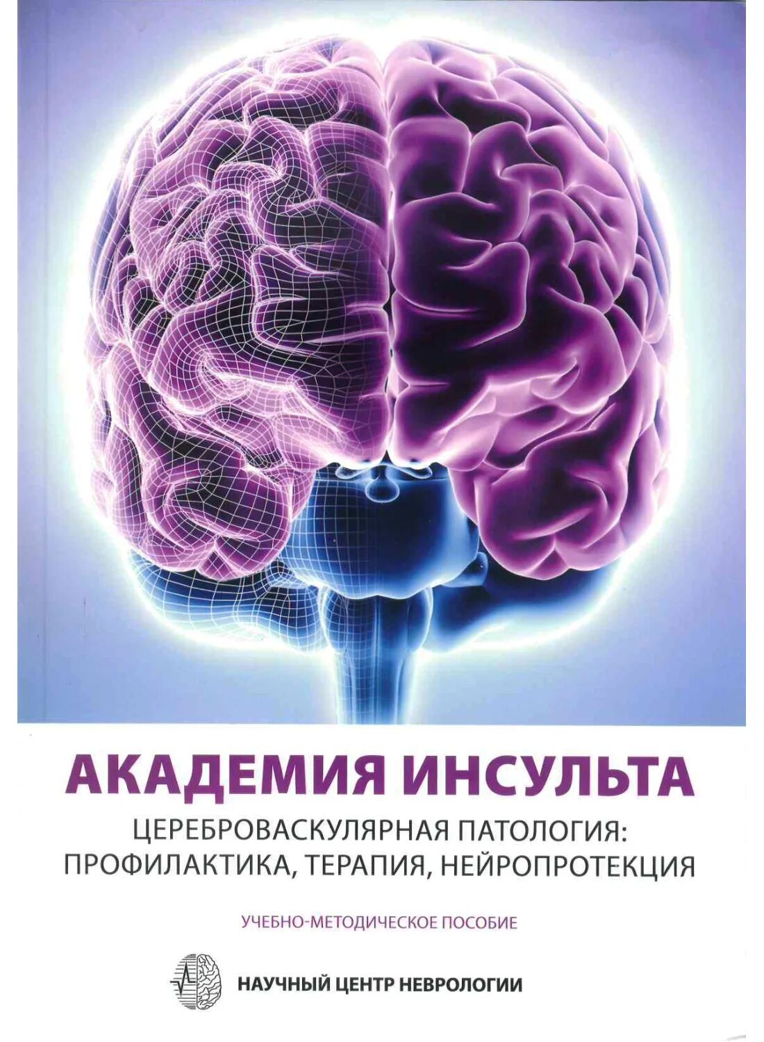 Цереброваскулярная терапия. Инсульт. Инсульт цереброваскулярный. Цереброваскулярная патология неврология.