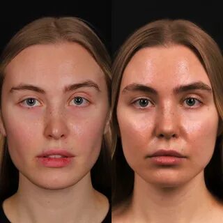 Спектр пластическая хирургия
