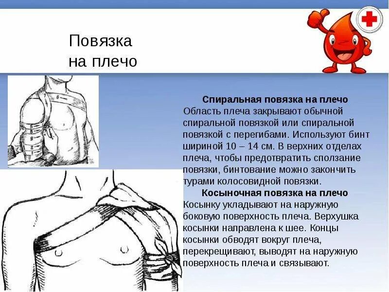 При вывихе плеча применяют повязку спиральную