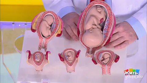 Беременна жить