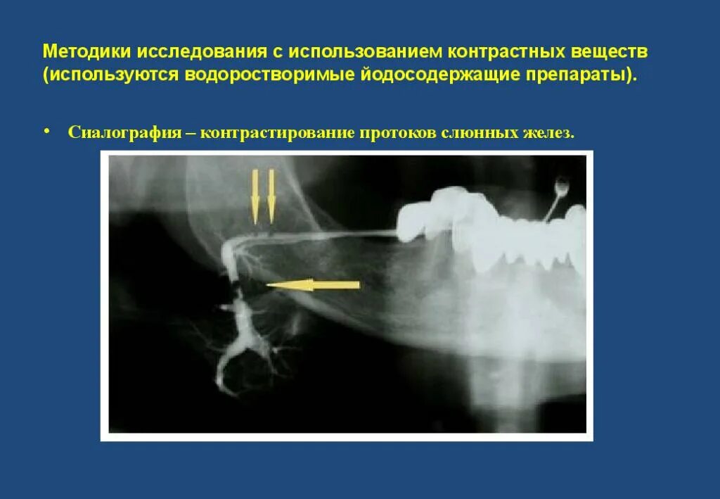 Методы изучения слюны физиология. Методы исследования слюнных желез. Методы исследования слюнных желез. Капсула лешли красногорского. Методы изучения деятельности слюнных желез.