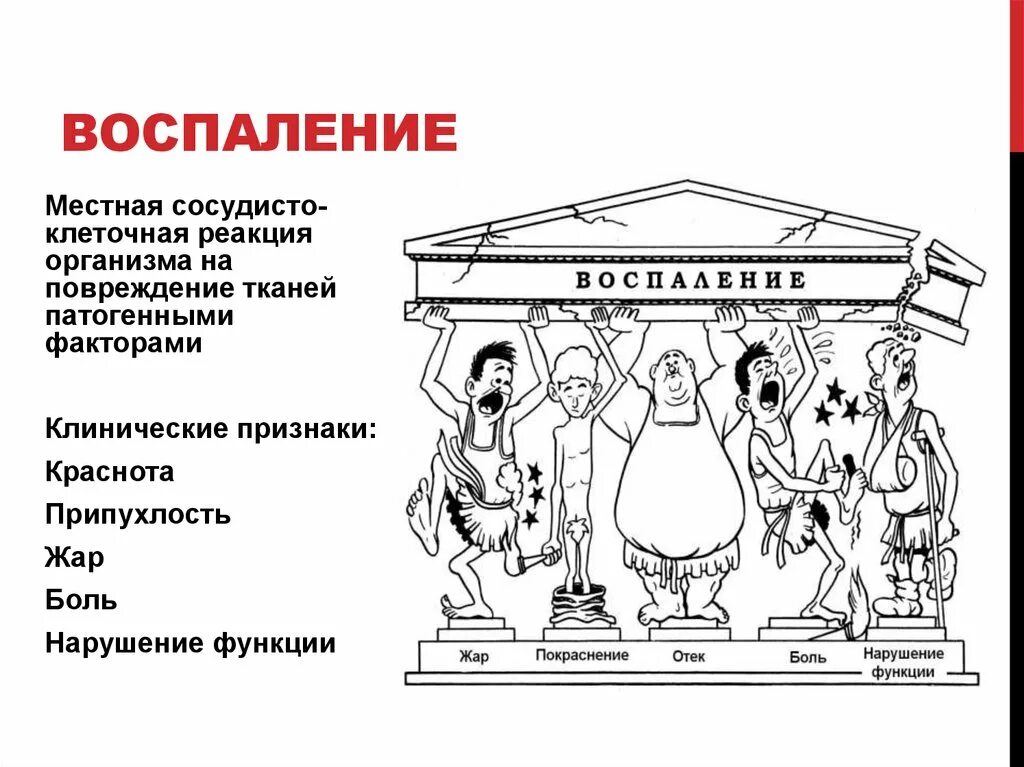 Признак воспаления dolor. Клинические признаки воспаления. Общие признаки воспаления. Местные и Общие признаки воспаления. Пять признаков воспаления.