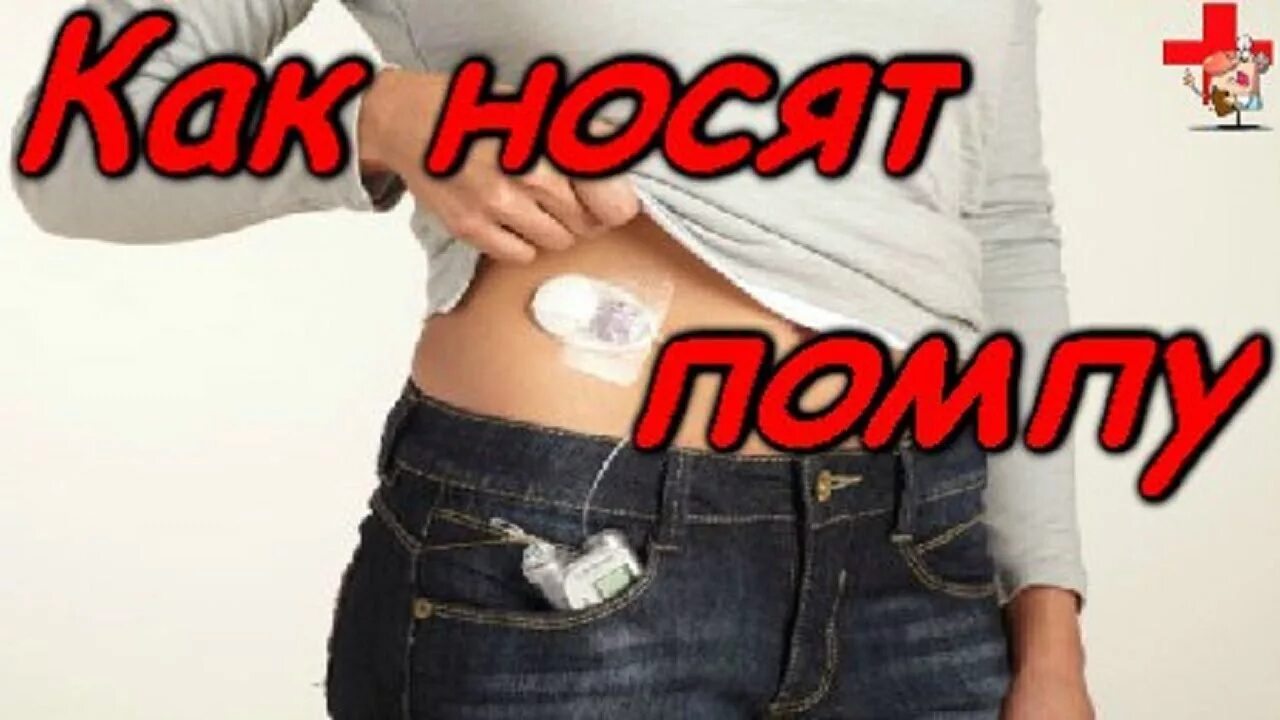 Как одеть помпу. Как носить инсулиновую помпу. помпа 780g инсулиновая. инсулиновая помпа под одеждой. как носить помпу.
